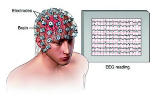 On the Application of Metaheuristics and Deep Wavelet Scattering Decompositions for the Prediction of Adolescent Psychosis Using EEG Brain Wave Signals